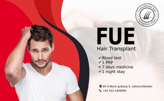 Fue hair transplant Lahore