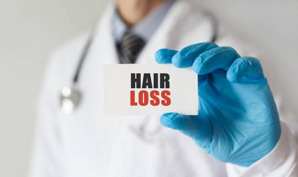 Hair loss treatment Norway