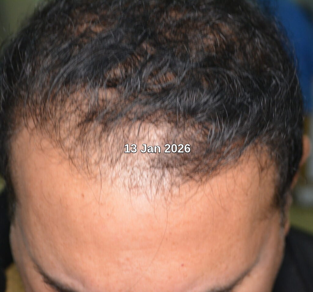 Bad habits that damage your hair Bad habits that damage your hair