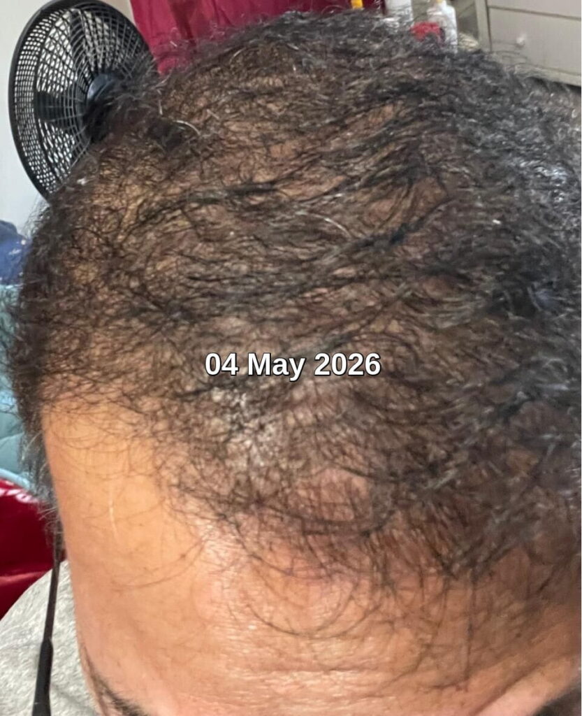How to fix hair damage How to fix hair damage