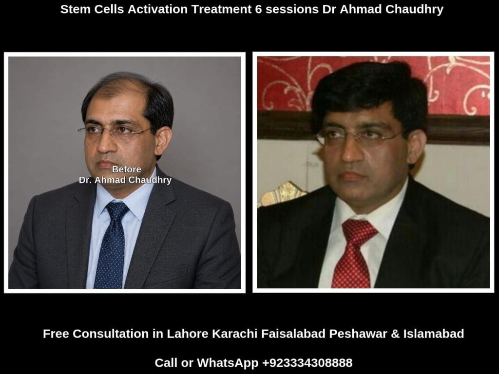 Free hair loss advice Pakistan