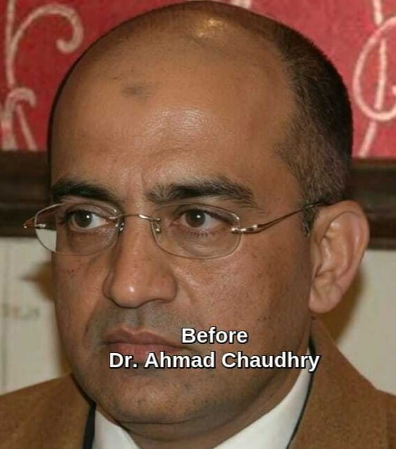 Hair loss advise and treatments