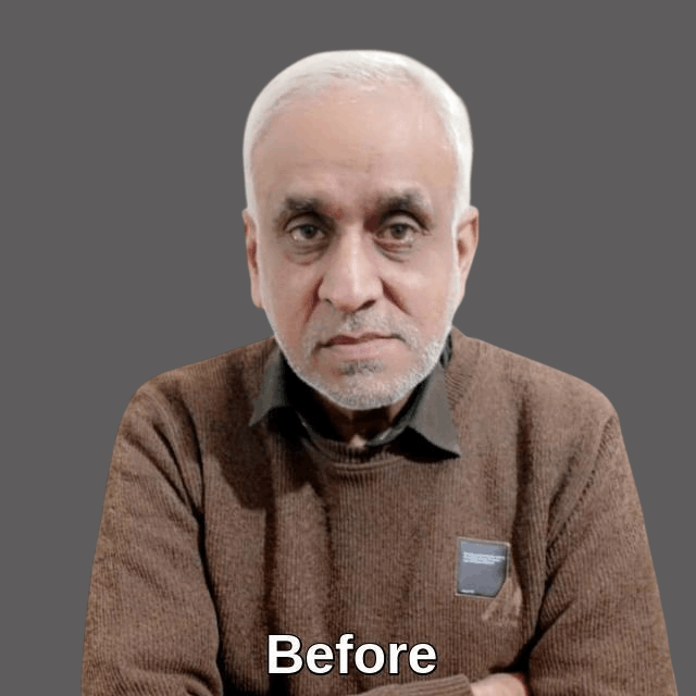 How to prevent hair fall